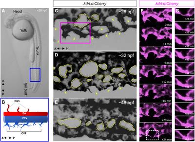 Endothelial cilia dysfunction in pathogenesis of hereditary hemorrhagic telangiectasia